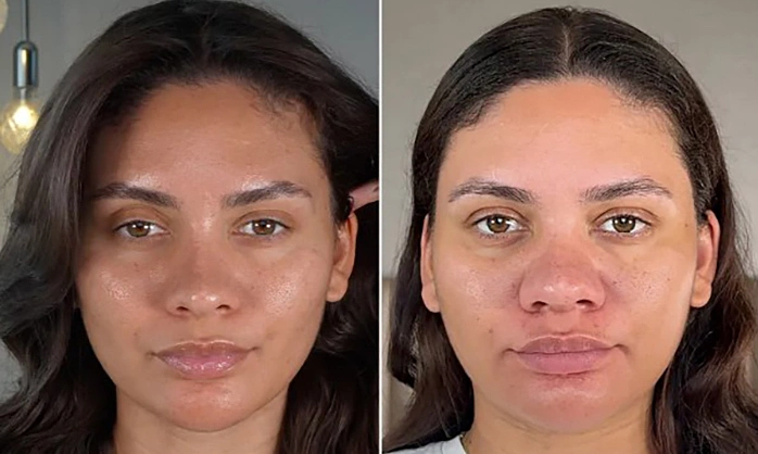 “나조차 못 알아봐”… 두바이 뷰티 인플루언서, 임신 후 ‘코 부기’ 고백에 400만 열광