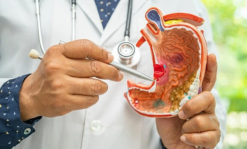 목의 작은 혹인 줄 알았는데… 중국 20대 여성, 말기 위암 진단