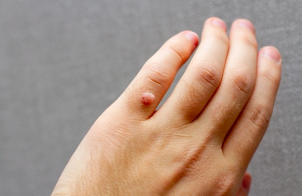 피부과 전문의 경고