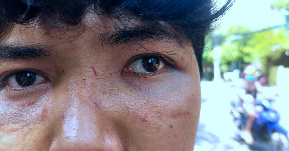 뀌뇬 '반베오 노점상' 폭행 잔혹사... 말리던 아들도 얻어맞고 칼부림 위협까지