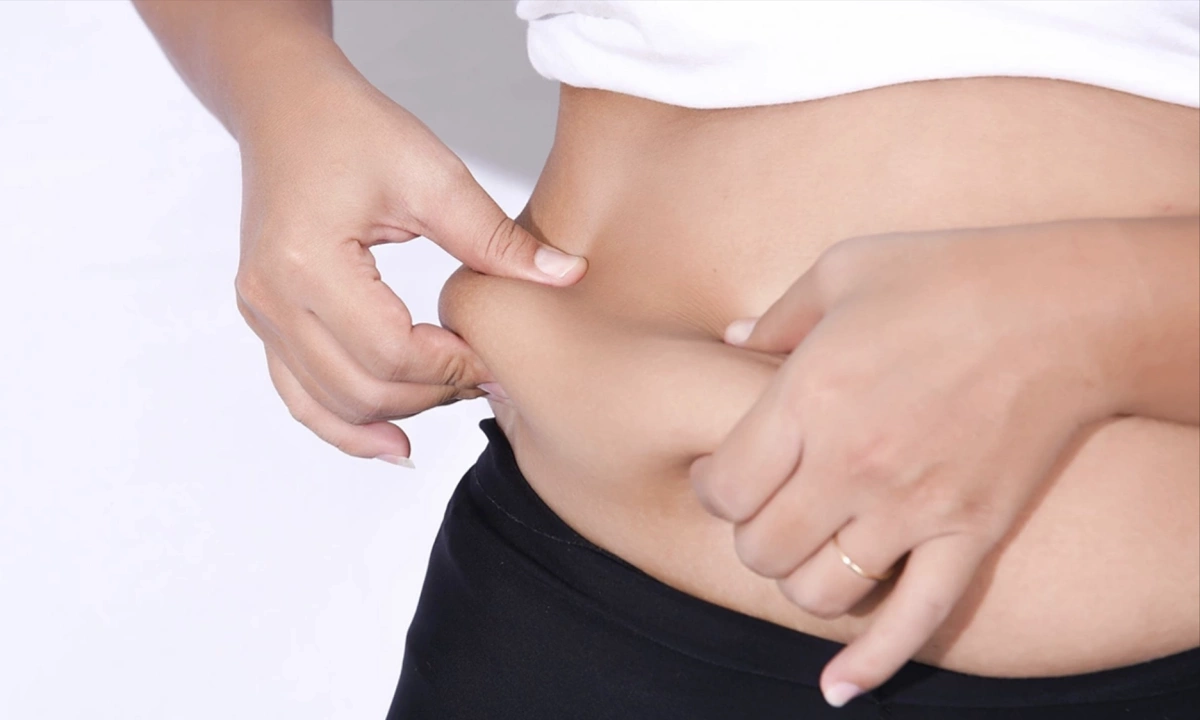늘어진 뱃살, 단순 비만 아니다… 전문가가 꼽은 복부 지방의 4대 '주범'