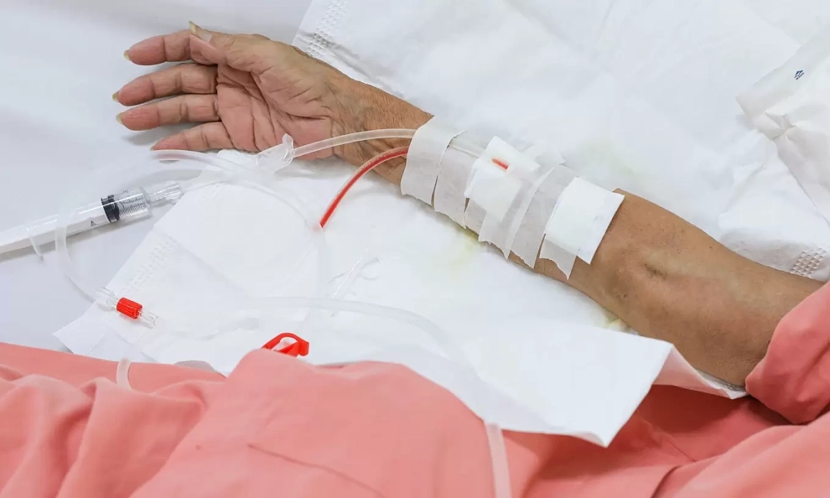 의사가 경고하는 신장 급성 손상 유발 10가지 약물 리스트