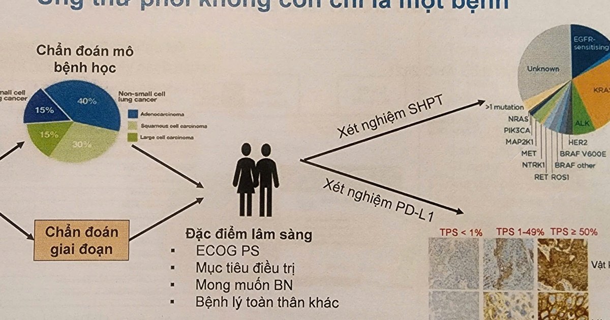폐암 초기 증상, 단순 호흡기 질환으로 오인해 치료 시기 놓쳐