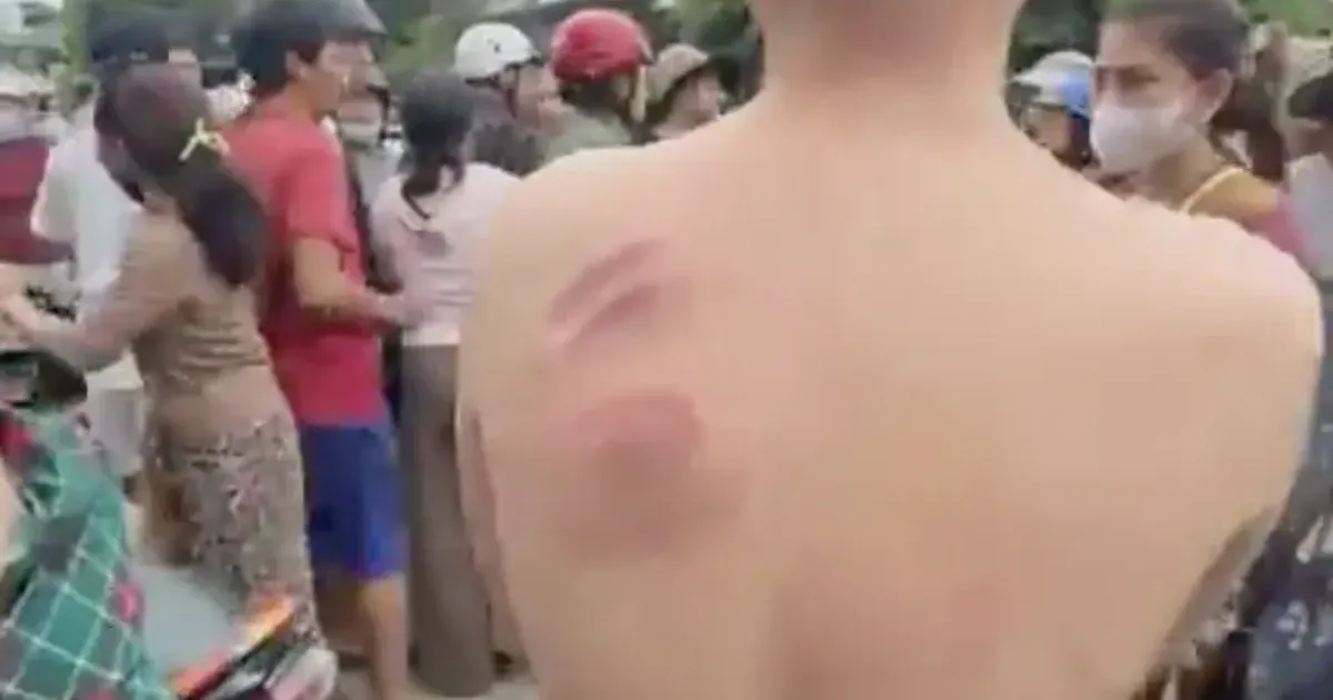 교통경찰 추격 중 10대 전동자전거 사고 의혹…Gia Lai서 진상조사