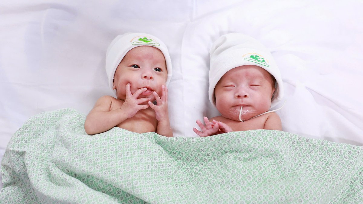 하노이 쌍둥이 미숙아, 태어나자마자 생존 사투
